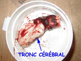 le tronc c&eacute;r&eacute;bral